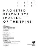 Magnetic resonance imaging of the spine